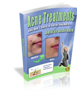 Acne Treatments