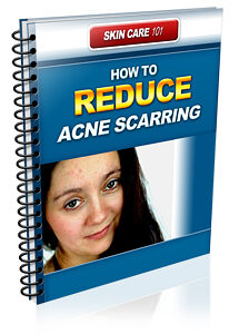 How To Reduce Acne Scarring